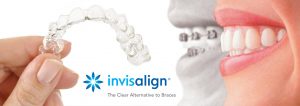 invisalign clinica dental algemesi