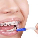 Accesorios necesarios para una higiene oral completa