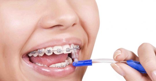 Accesorios necesarios para una higiene oral completa