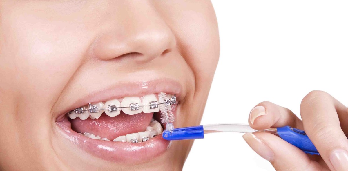 Accesorios para oral completa - Clínica dental Alicia Felici