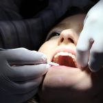 Importancia de una limpieza dental profesional