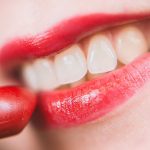 Tipos de blanqueamiento dental seguro