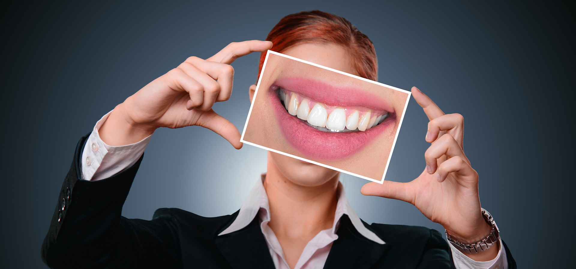 Carillas dentales - para qué sirven y qué tipos hay - Clínica dental Alicia  Felici