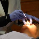 Enfermedades implantes dentales – ¿Cuáles aparecen por su uso?